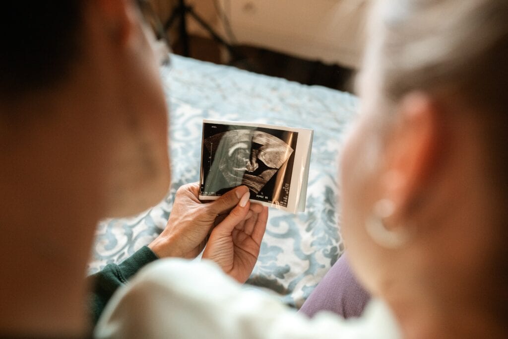 two women looking at a photo of a pregnancy scan